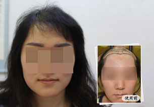 治療案例