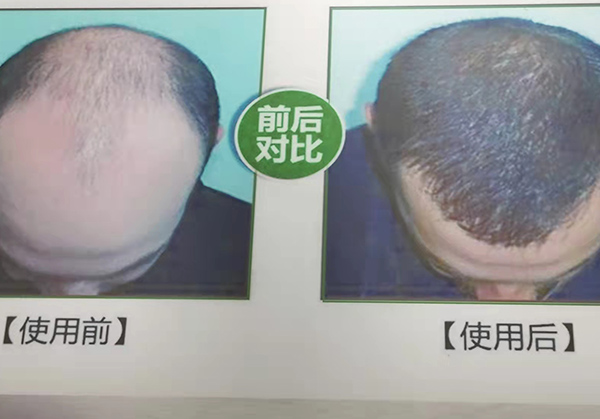治療案例