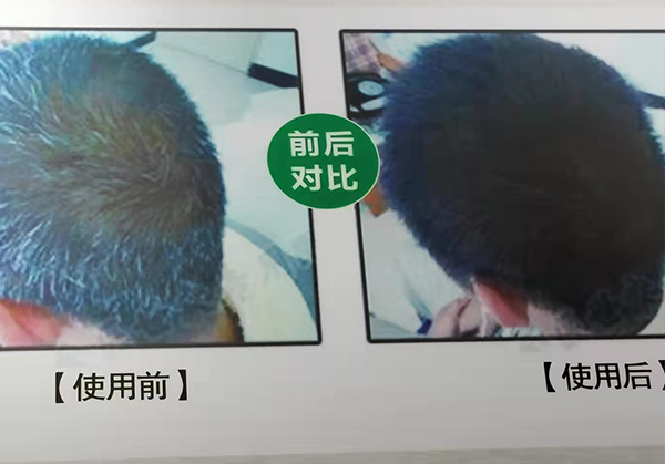 治療案例
